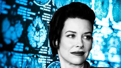 Accidente cráneo cerebral de actriz de “Lost”: ¿Qué tipo de daño puede producir?