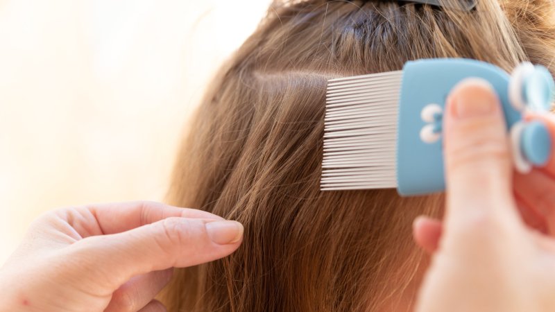 Ojo, piojo: Consejos para combatir un recurrente problema tras la vuelta a clases