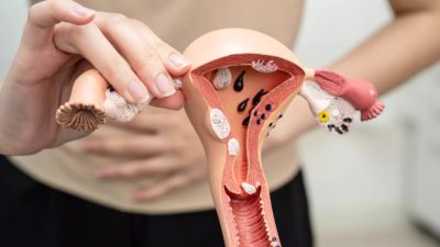 Día mundial del cáncer de ovario: 7 de cada 10 casos se detectan tarde