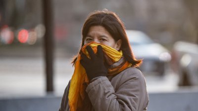 Termómetro en baja, resequedad en alza: El impacto que tienen las bajas temperaturas en la piel