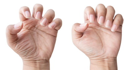 ¿Por qué es importante revisar las uñas? Los cambios que pueden entregar pistas sobre nuestra salud