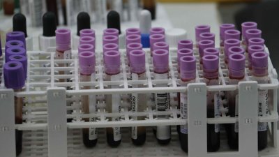 Estudio sostiene que la IA y el aprendizaje automático podrían detectar a personas en riesgo de sufrir cáncer